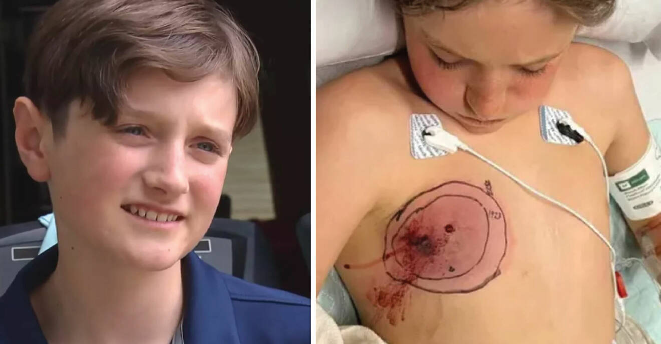 11-åringen ramlade av cykeln – blev biten av livsfarliga ormen: ”Tuff pojke”