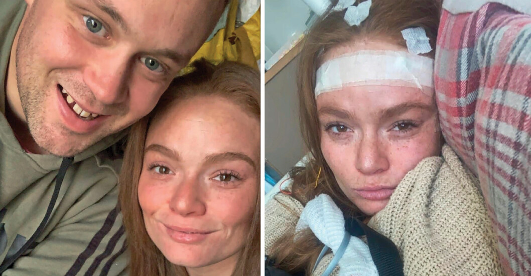 Emilys, 27, mobbare förstörde hennes liv – drabbades av svår sjukdom: ”Slippa…”