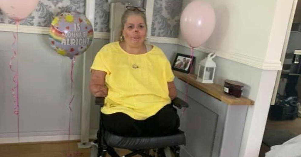 <strong>När Susan vaknade upp väntade en tuff rehab. Hon kunde inte prata och på ett år vägrade hon se sig själv i spegeln. Hon kunde inte acceptera hur hon såg ut efter amputationerna.</strong> När Susan vaknade upp väntade en tuff rehab. Hon kunde inte prata och på ett år vägrade hon se sig själv i spegeln. Hon ville inte acceptera hur hon såg ut efter amputationerna.