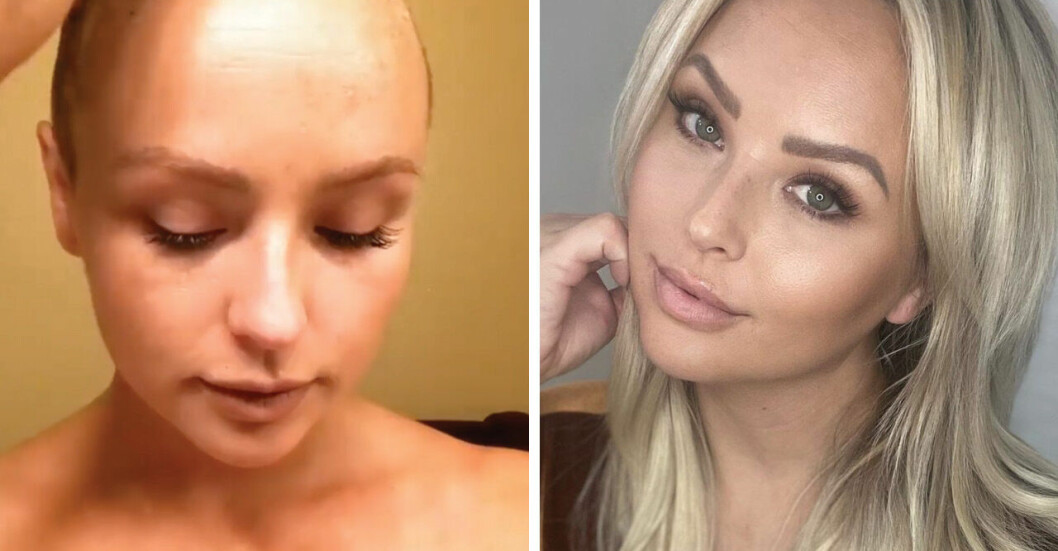 35-åriga modellens dödsdom – efter läkarnas miss: ”Stort misstag”