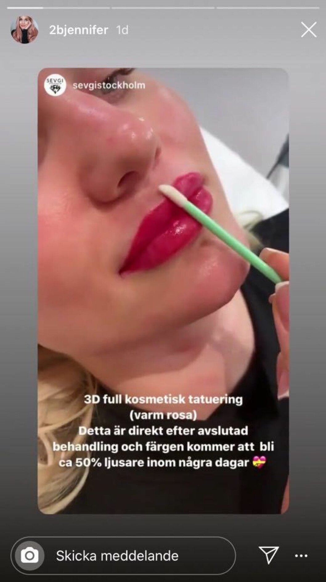 Jennifer Karlsson förklarar att färgen kommer lägga sig om ett par dagar.