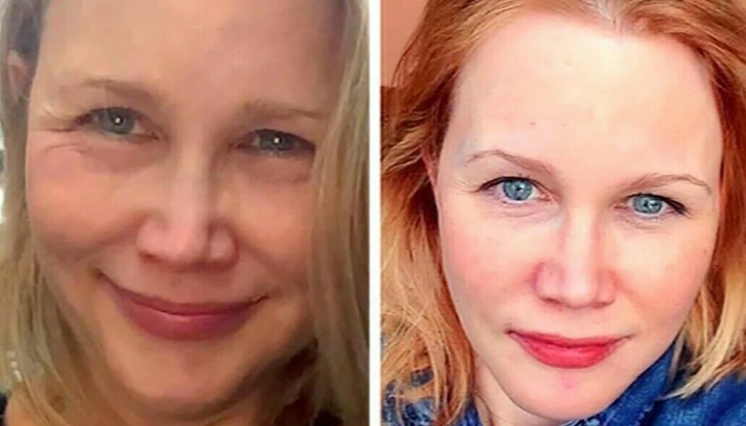 Gina Anderson fick vad hon trodde var fillers i 40-årspresent av en kollega.