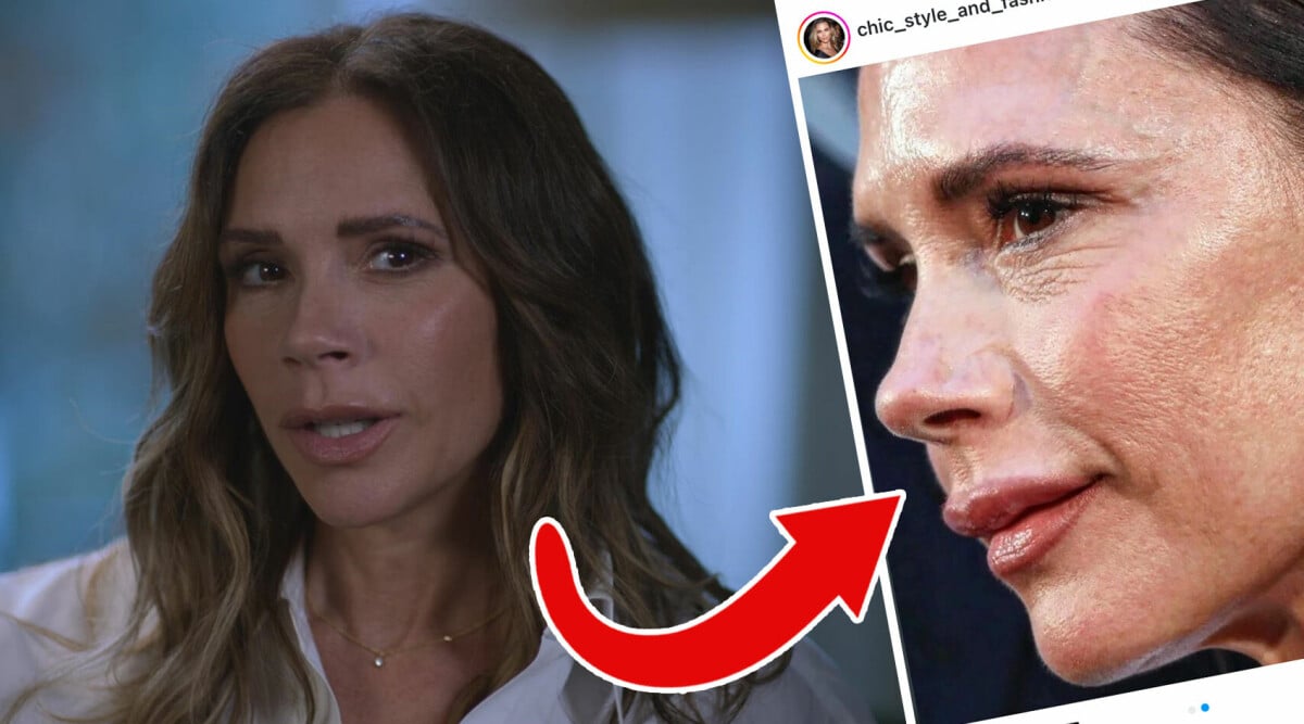 Chockbilderna på Victoria Beckham – totalt förändrad: ”Fattar inte”