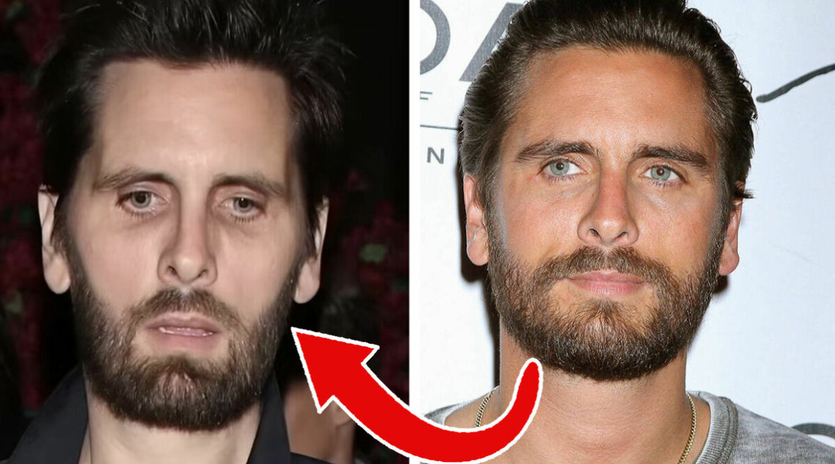 Nya skräckbilderna på Scott Disick – förstörd efter bråken med Kourtney