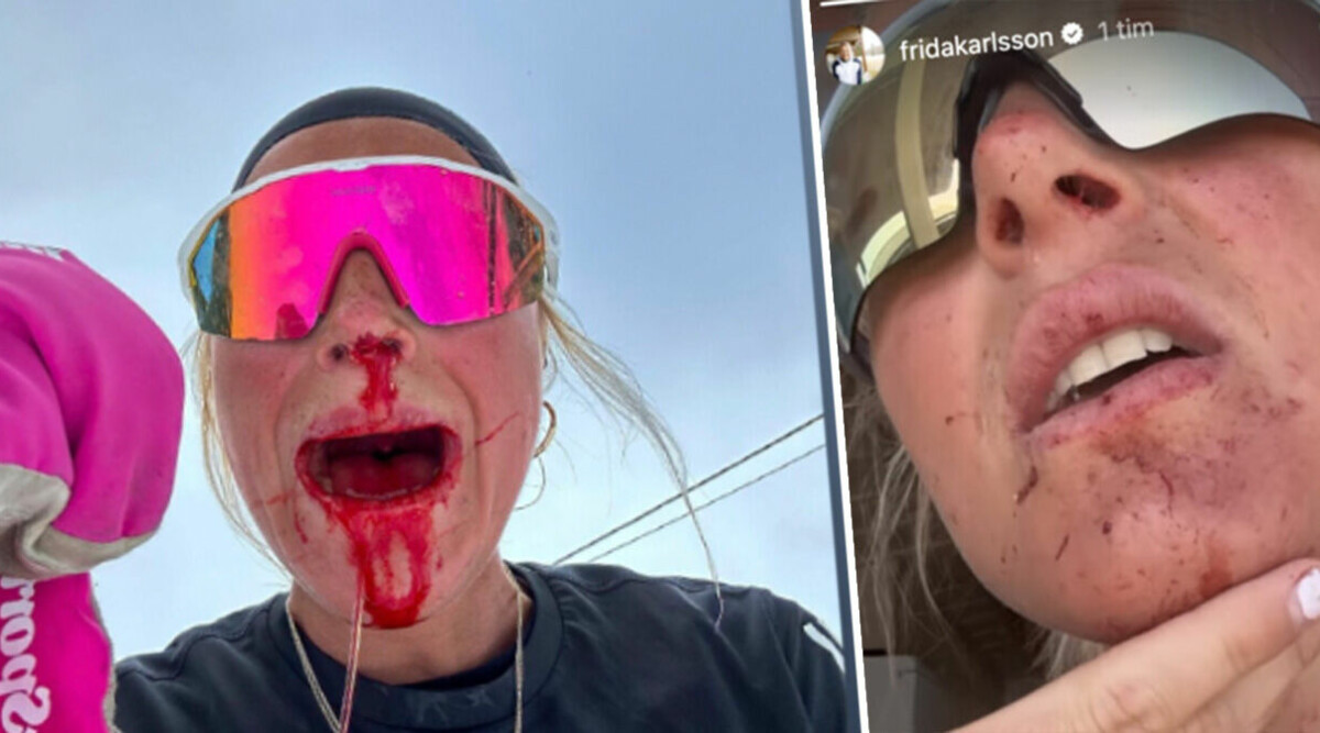 Frida Karlsson i olycka – se dramatiska bilderna: ”Ser ut som en slaktplats”