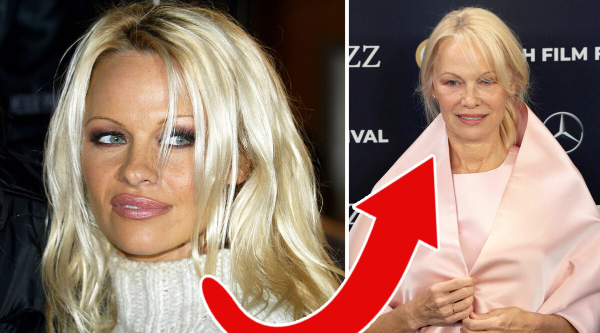 Pamela Anderson helt oigenkännlig med nytt utseende – hyllas som ”världens vackraste”