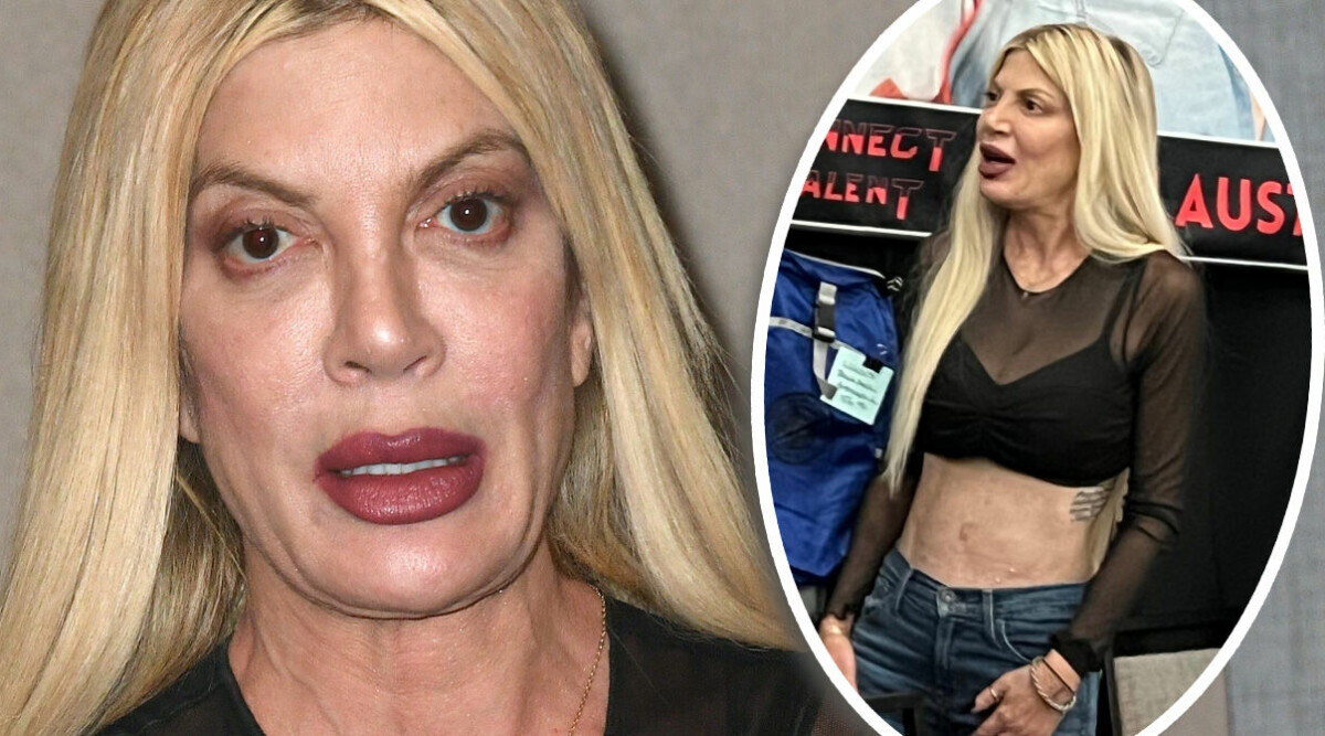 Chockbilderna på Tori Spelling – går inte att känna igen: "Vad har hänt?”