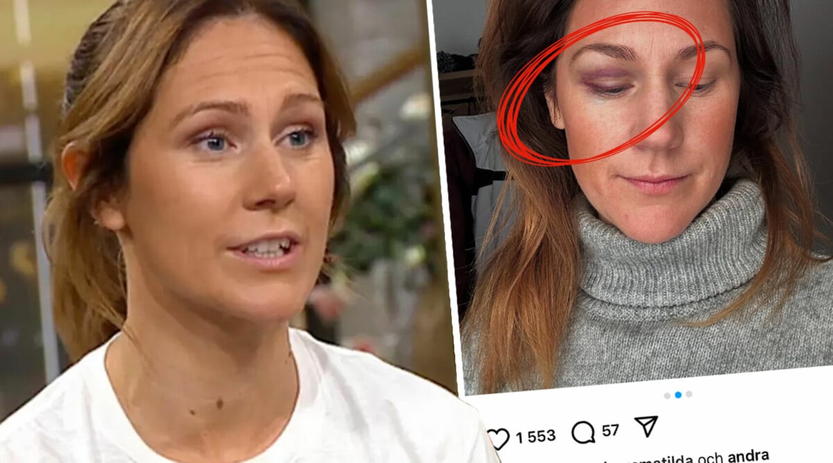 Maria Forsblom blåslagen – så döljs allt i Nyhetsmorgon: ”Extra tacksam”