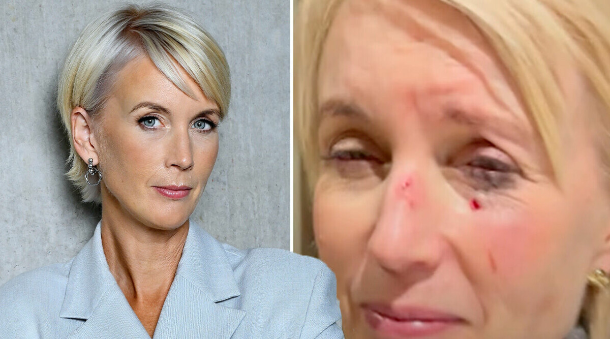 Skräckbilderna på Jenny Strömstedt i Nyhetsmorgon – här är ofattbara olyckan