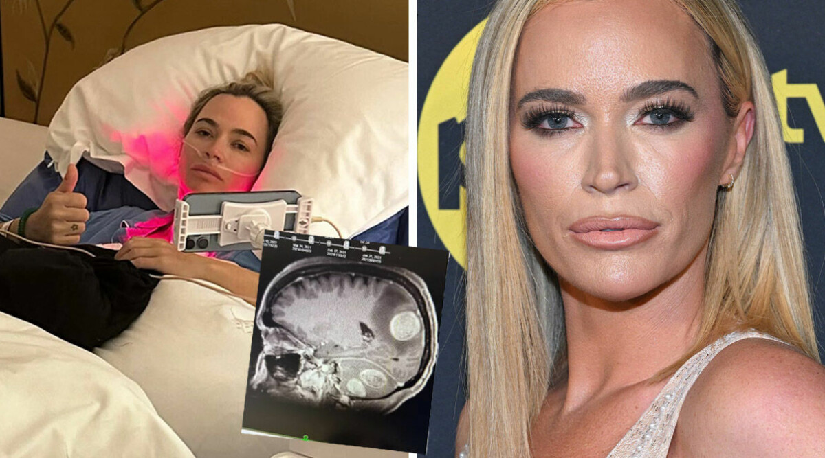 Tv-profilens kamp mot cancern – nu har den spridit sig: ”Jag vill överleva för mina barn”