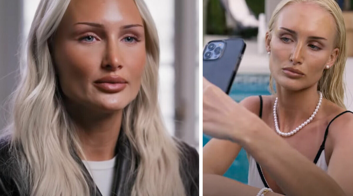 Lovisa Worge talar ut om operationen: ”Det här är inte min kropp”