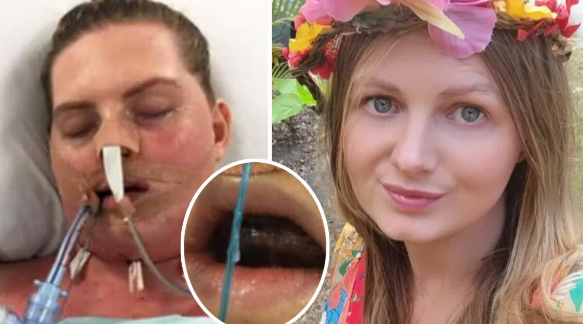 27-åriga kvinnan hamnade i koma – chockerande fyndet i munnen
