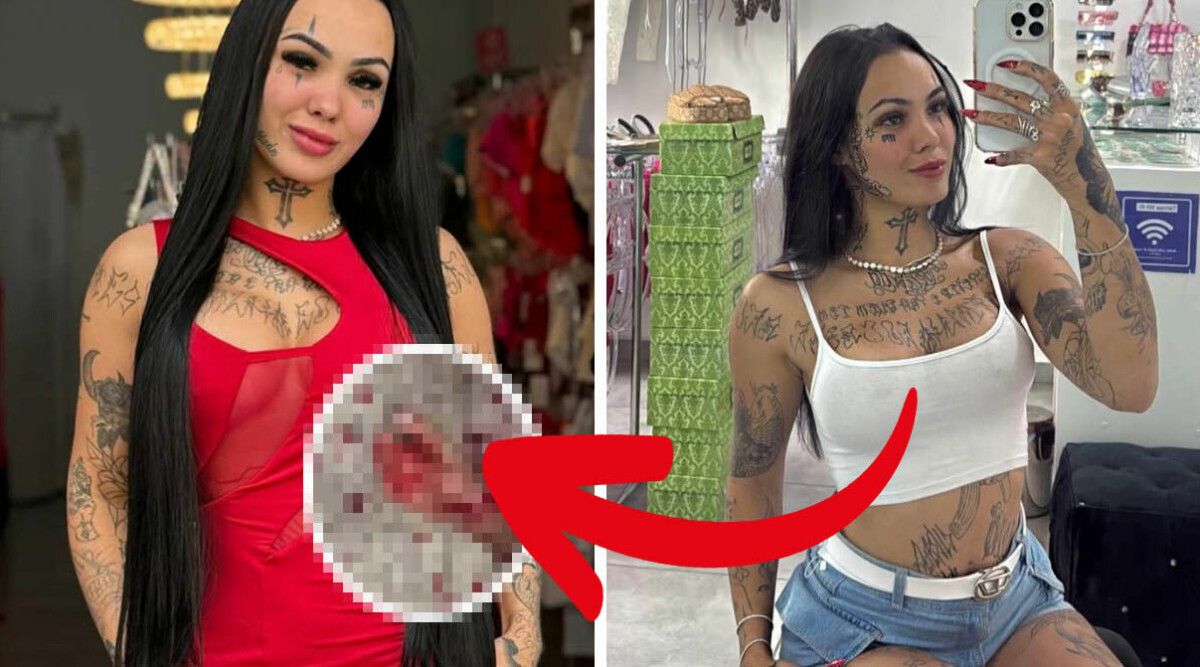Influencern knivhuggen av pojkvännen i direktsändning – kämpar för sitt liv