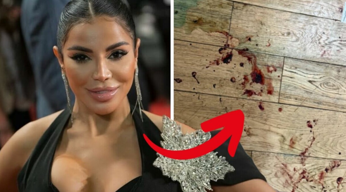 Influencer attackerad i sitt hem