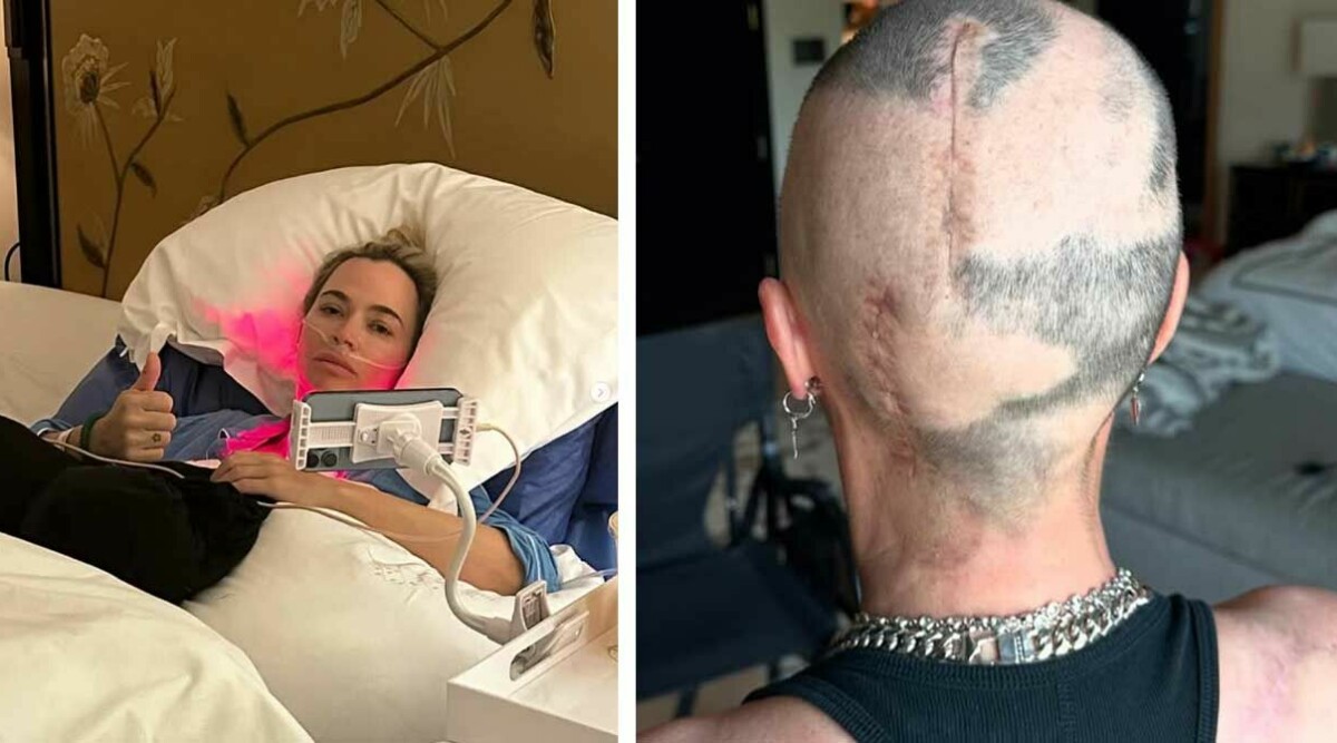 Folkkära tv-profilen har cancer i stadie 4 – nu avslutas behandlingen: ”Blir allt sämre”
