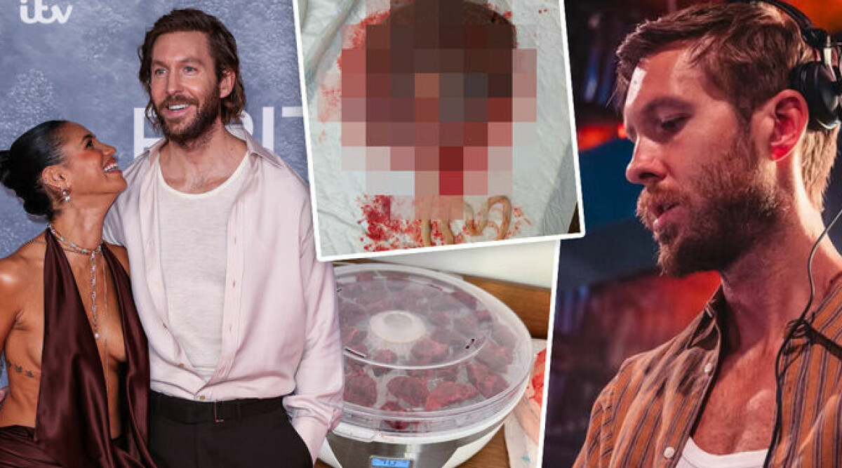 Världsberömda dj:en har fått barn – chockbilderna efter förlossningen