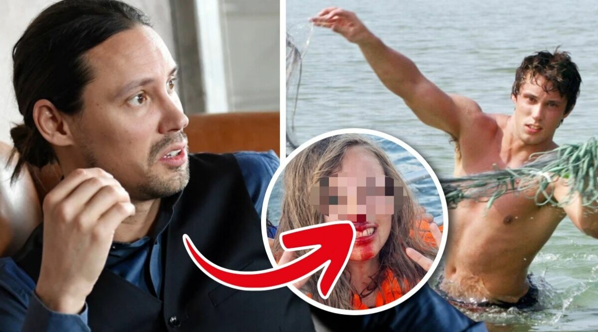 Robinson-Robbans dotter i blodig olycka: ”Bröt näsbenet”