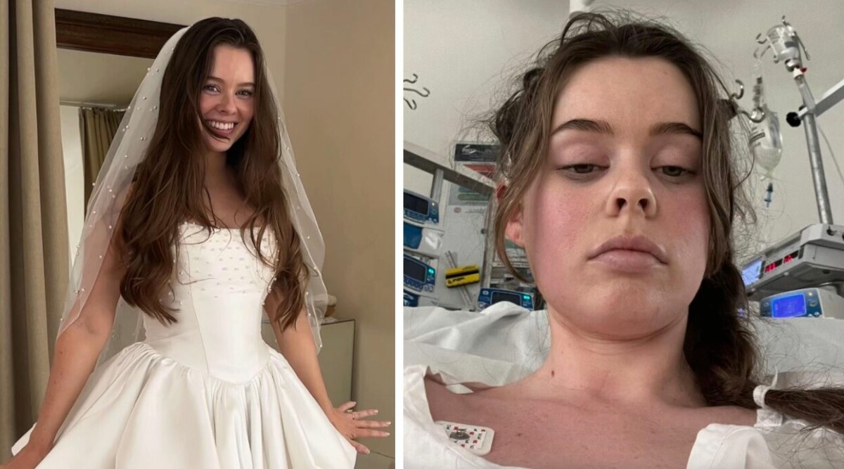 Influencern drabbad av dödlig hjärntumör – upptäcktes mitt under bröllopsplaneringen