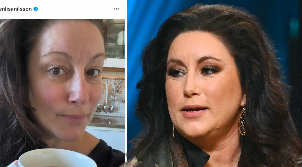 Lisa Nilsson om äckliga ingreppet hos läkaren – uppskuren med skalpell