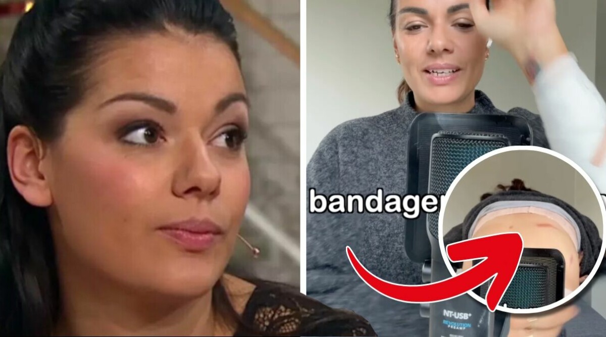 Carin Da Silva helt blåslagen – släpad i grus: ”Bloddränkt arm”