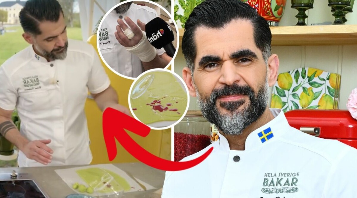 Blodiga olyckan i Hela Sverige bakar – akut till sjukhus: ”Ingen känsel”