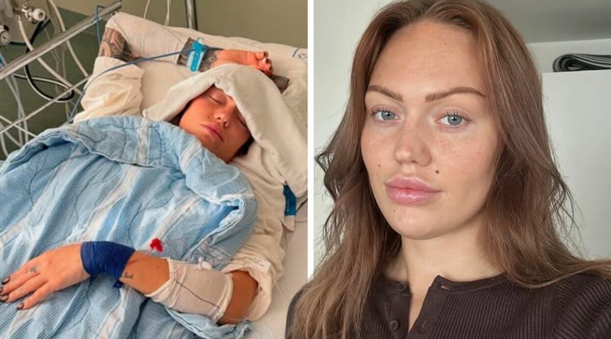 Svenska influencern i svår olycka – kampen för sitt liv: ”Fått en hjärnblödning”