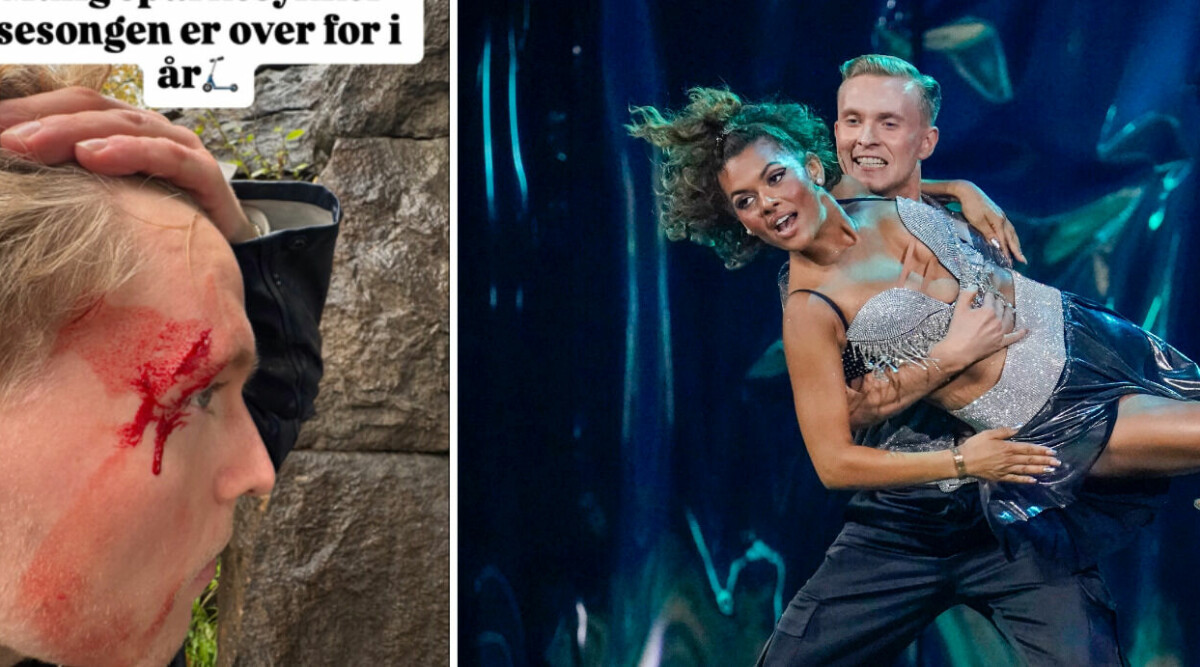 LÄSKIGA BILDERNA! Tv-profilens blodiga olycka: ”Panik”