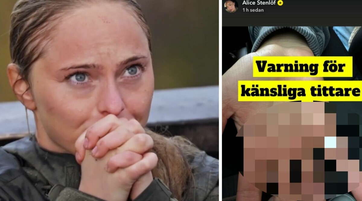 BILDERNA: Alice Stenlöfs skador efter programmet • ”Varning för känsliga tittare”