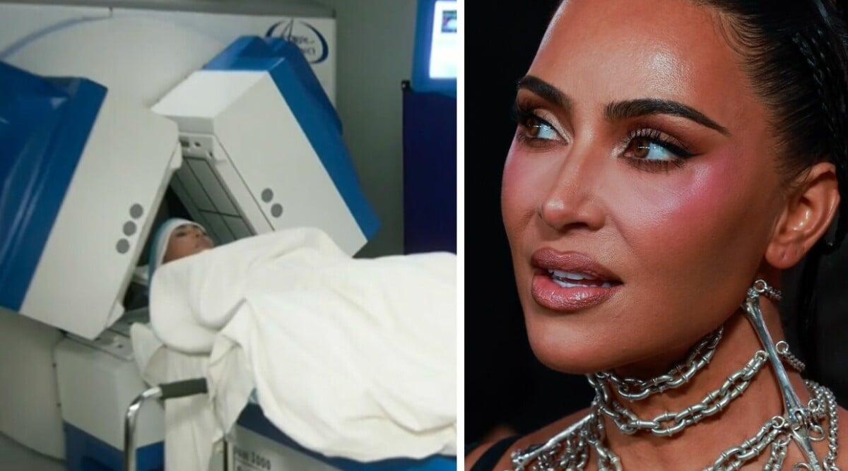 Kim Kardashian behandlas för hjärnblödning – anklagar Kanye West