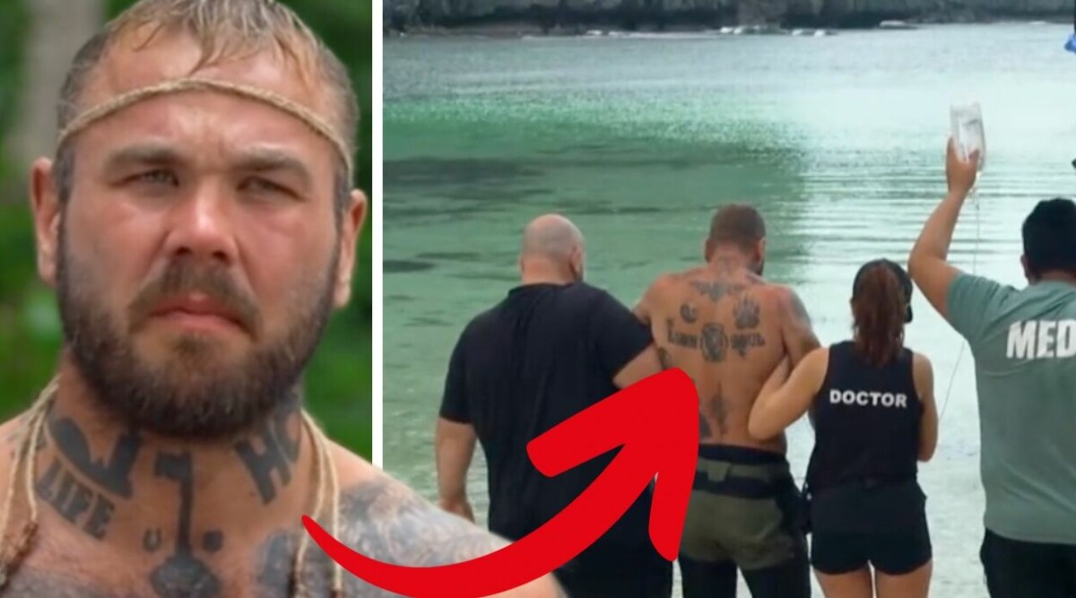 Robinson-Jacob kollapsar på ön – akut till sjukhus • Sanningen om avhoppet: ”Lett till stora livsförändringar”