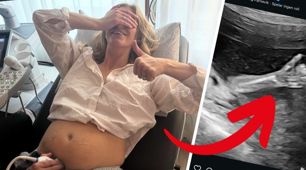 Penny Parnevik blundar för upptäckten på ultraljudet – otroliga bilden visar lyckan!