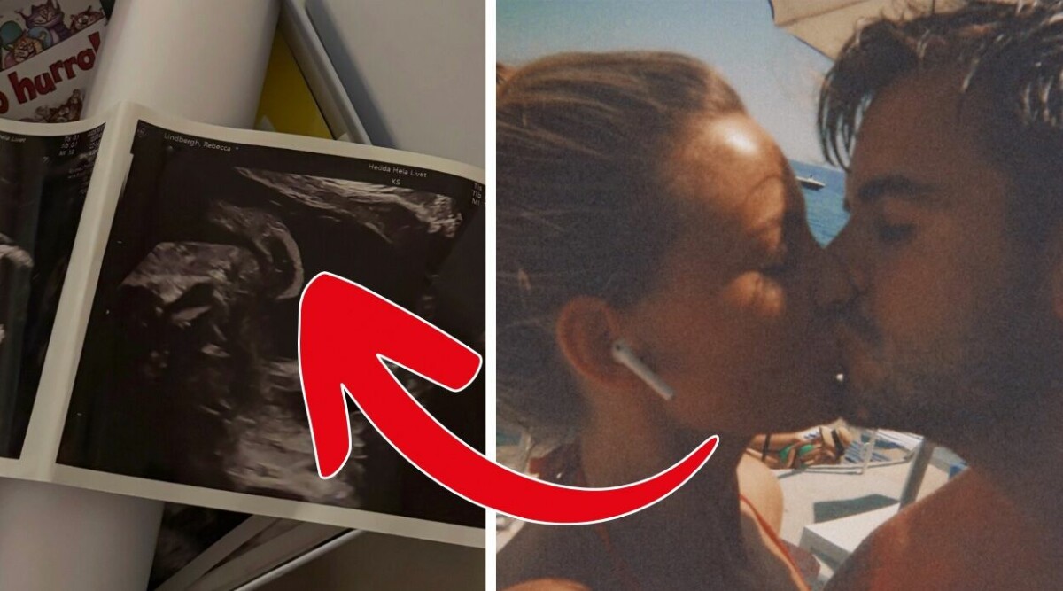 Nä men, gör han inte...? Sjuka detaljen på ultraljudet!