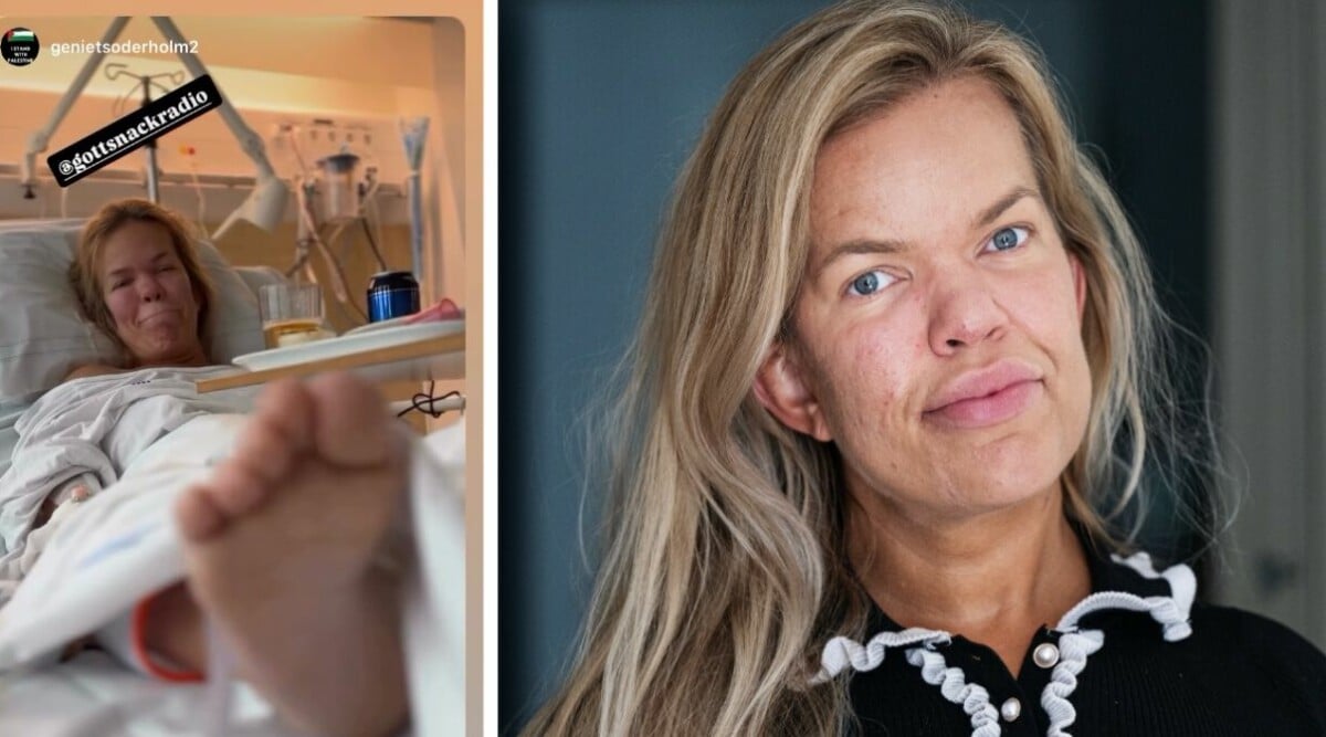 Sanna Dollan akutopereras – läkarnas varning: ”Risk för förlamning”