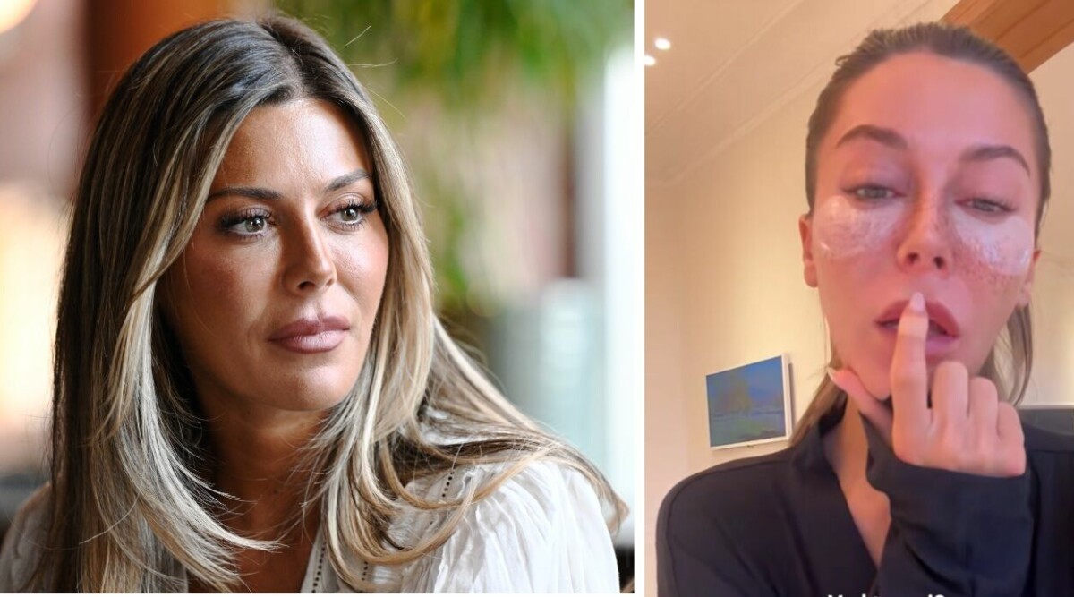 Bianca Ingrosso ångrar skönhetsingreppet – varnar följarna: ”Värsta jag har gjort”