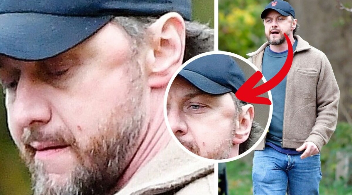 Skräckbilderna på folkkära skådespelaren – ansiktet förstört efter våldsam attack!