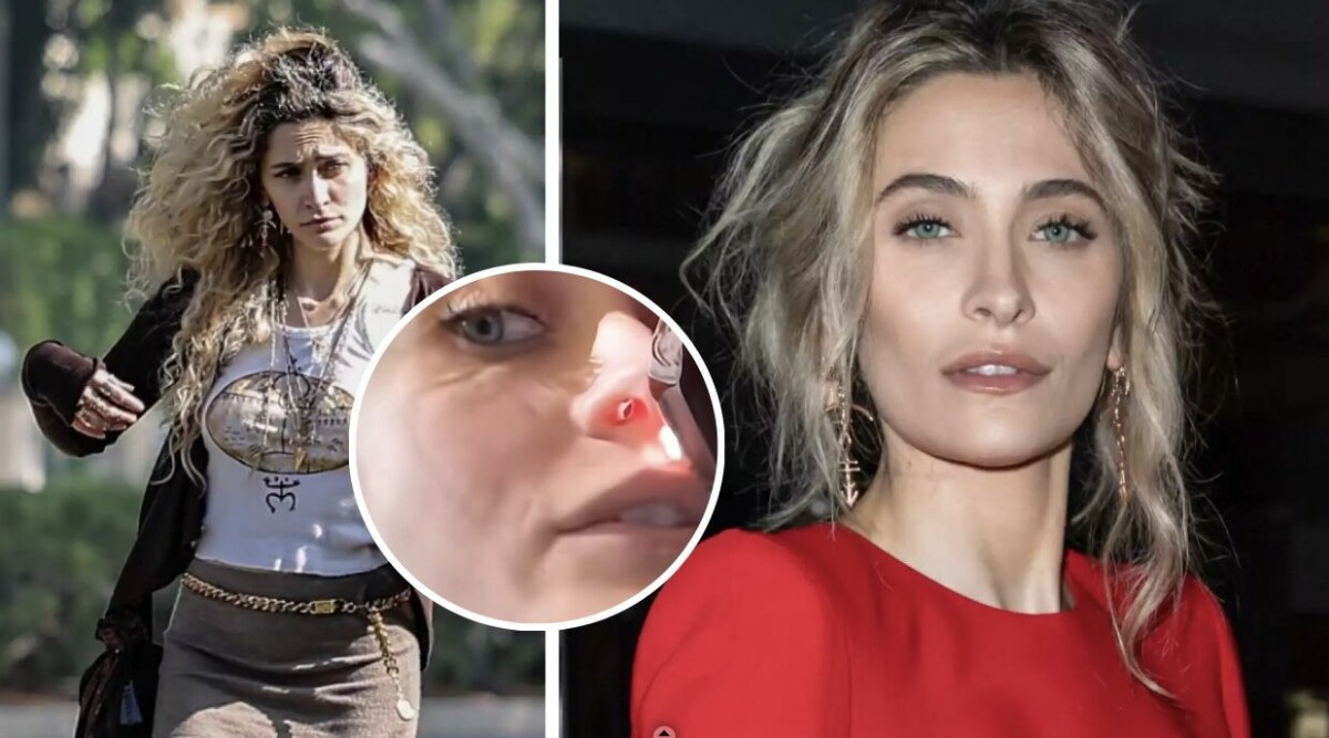 Chockbilden på Michael Jacksons dotter – näsan förstörd efter drogmissbruket