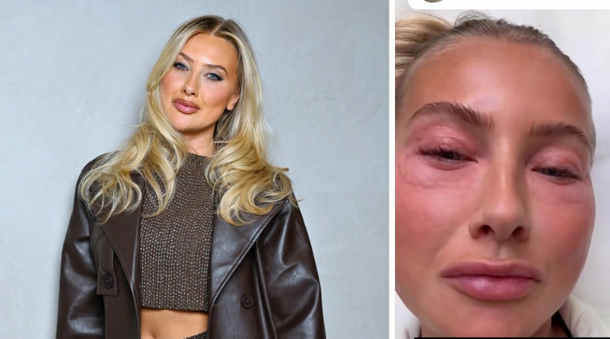 CHOCKBILDERNA! Hanna Fribergs nya utseende: ”Ser helt galen ut”