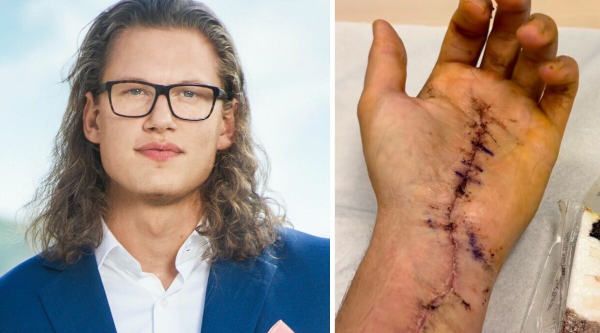 TV4-profilens mardrömsbesked – upptäckt två tumörer • Tvingad till akut operation