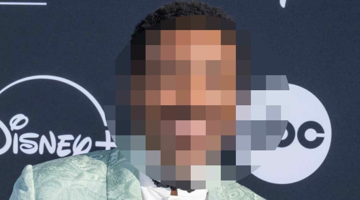 Folkkära artisten drabbad av stroke – 42-åringen akut opererad