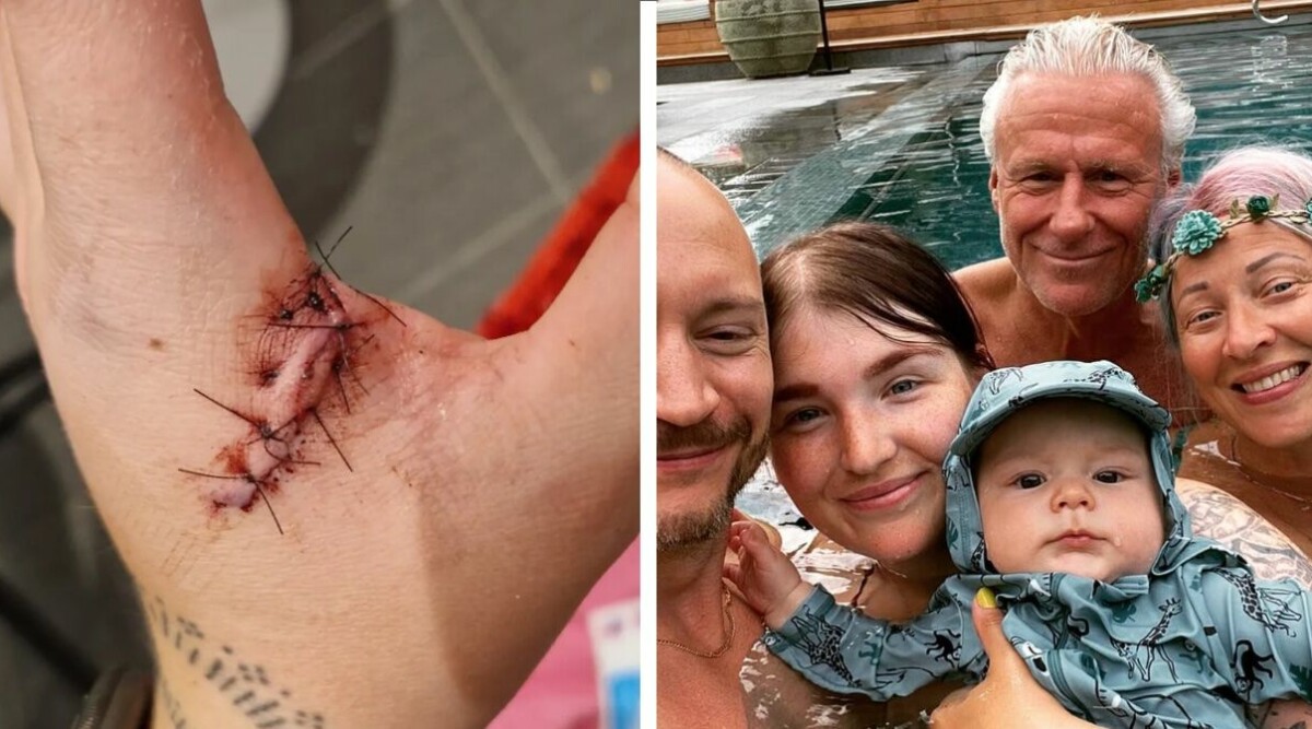 Björn Borgs dotter akut till sjukhus – visar upp svåra skadan: ”Skar upp hela handen”