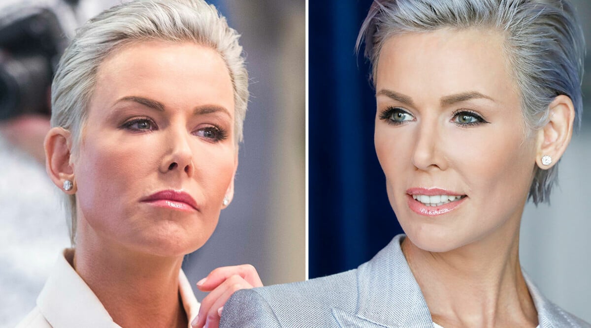 Gunhild Stordalen om sjukdomen systemisk skleros – dystra prognosen