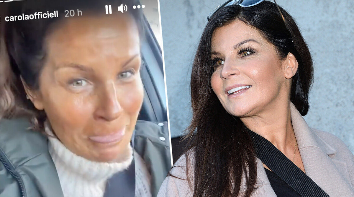 Carola Häggkvists skönhetsmiss – bilden visar plötsliga förändringen