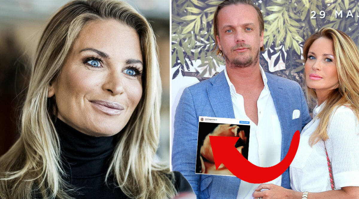 Carolina Gynnings första bild på ofödda dottern