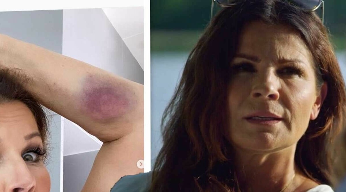 Carola Häggkvists olycka under inspelningen av Stjärnorna på slottet