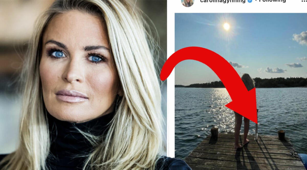 Carolina Gynnings vågade bild får följarna att reagera starkt