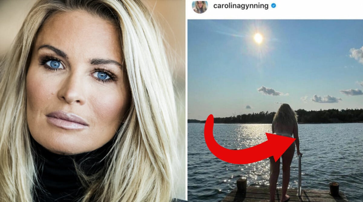 Carolina Gynning bryter tystnaden om den omtalade nakenbilden