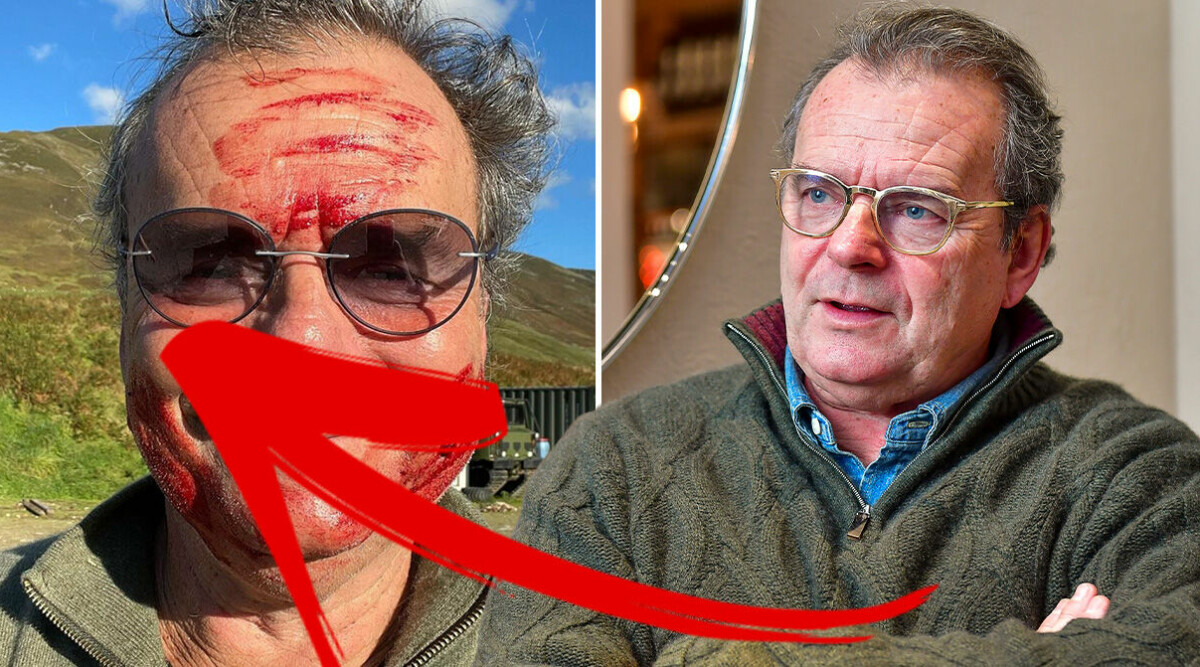 Starka reaktioner efter Steffo Törnquists nya bild på Instagram