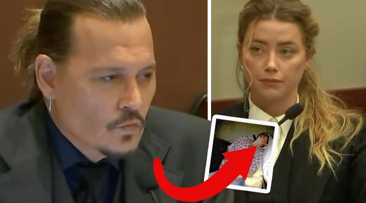 Chockbilderna på Johnny Depp avslöjade i rättegången med Amber Heard