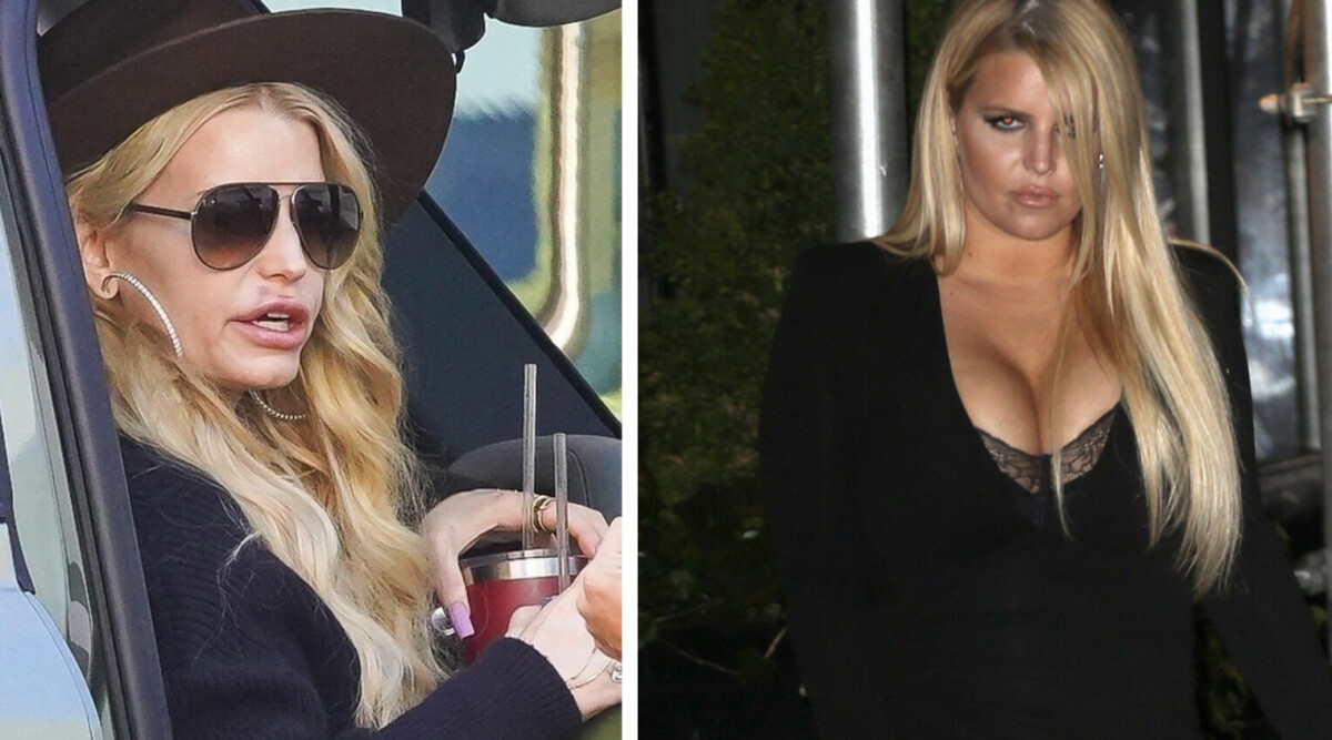 Maken vädjar till Jessica Simpson: ”Snälla, sluta med plastikingreppen!”