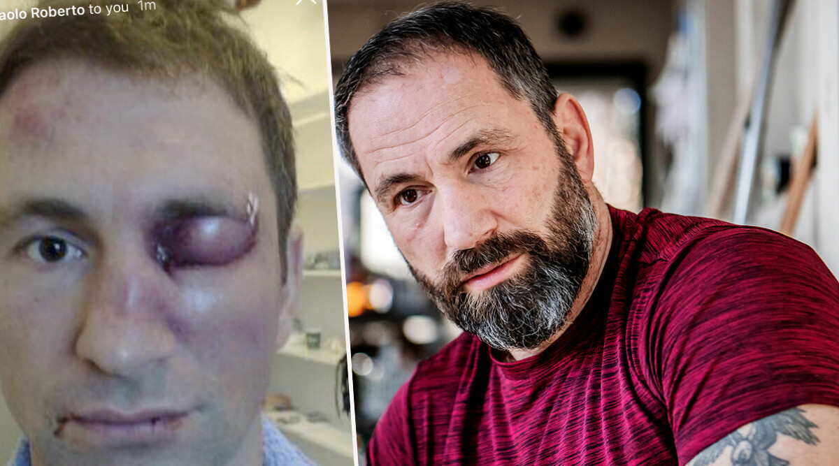 Chockbilden på Paolo Roberto – nu avslöjar han sanningen bakom